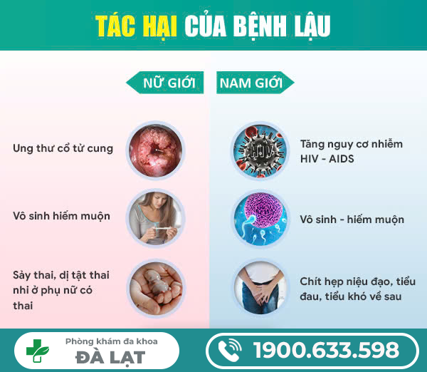 Hình ảnh minh họa